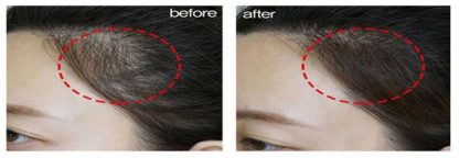 Sevich Haaransatz Make-up – Bild 8